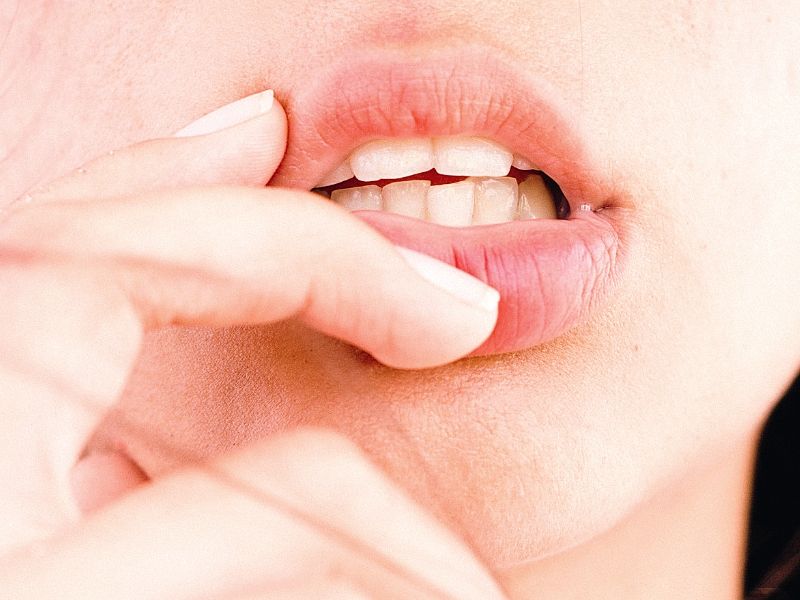 پیشگیری از کج شدن دندان ها