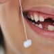 ارتودنسی و از دست دادن زودرس دندان شیری