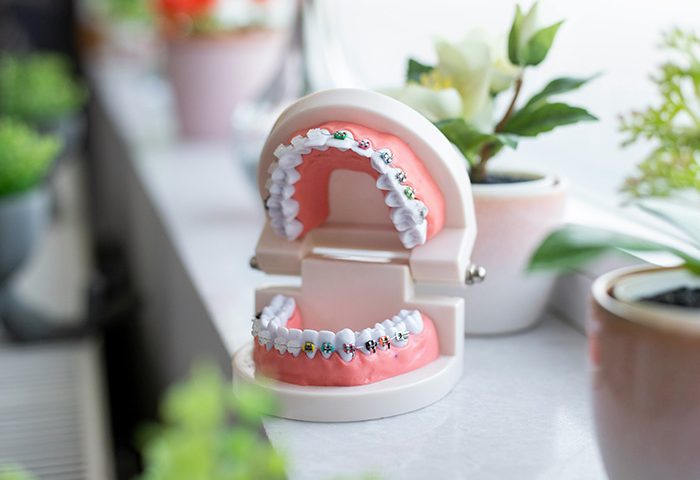 ارتودنسی دندان برای چه کسانی مناسب است