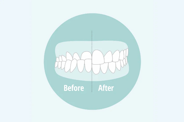 آندربایت چیست